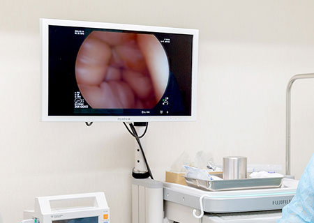 内視鏡を使って食道・胃・十二指腸を直接観察する検査です